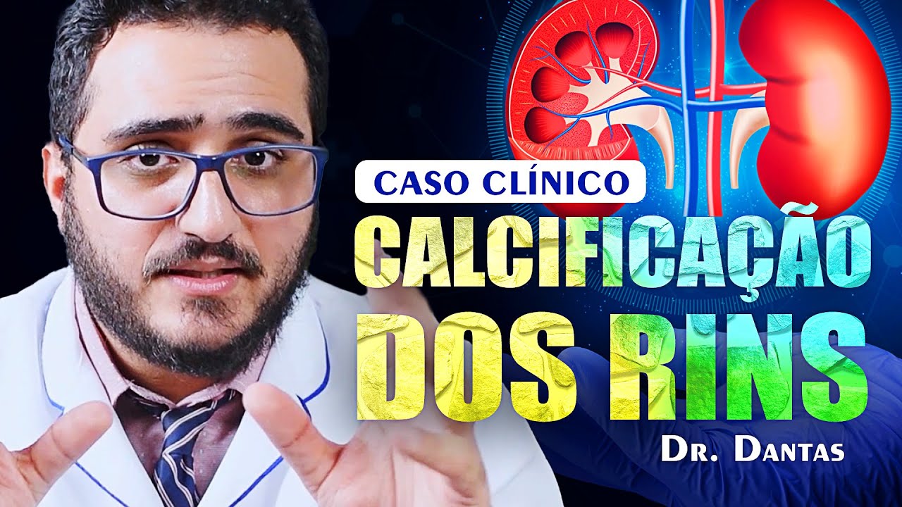 Os perigos da calcificação dos rins - Dr. Dantas