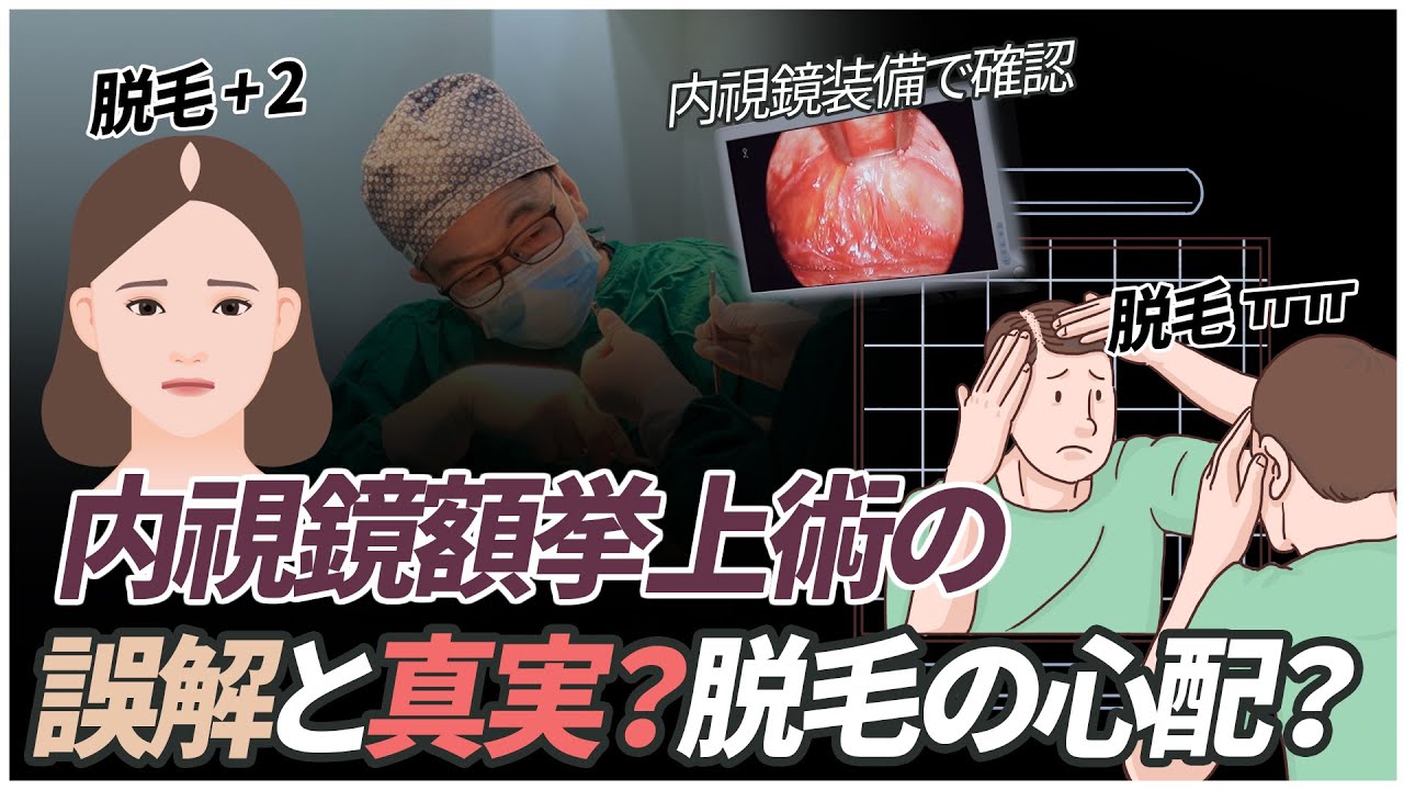 内視鏡額挙上術の誤解と真実？脱毛の心配？