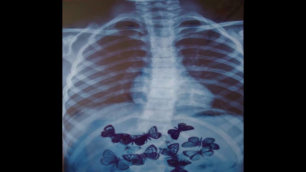 Don Toliver x Travis Scott Type Beat ~ Butterflies