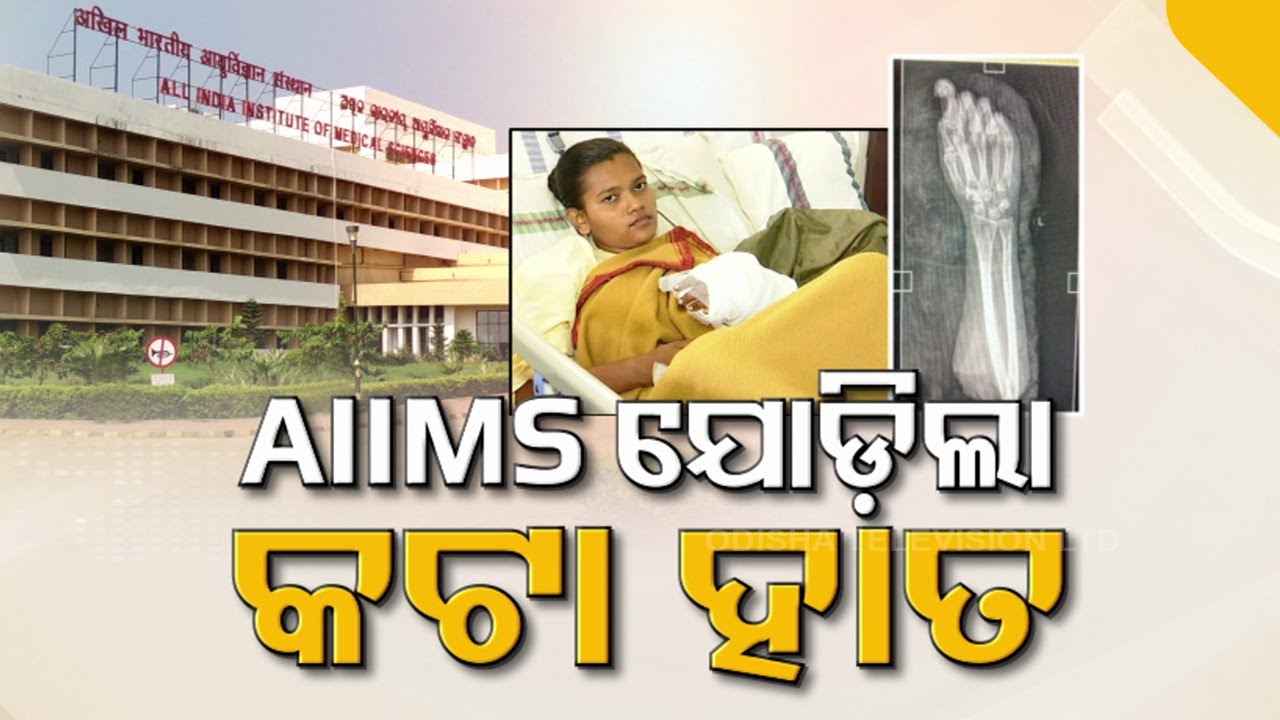AIIMS doctors give Odisha girl new lease of life, replant amputated hand