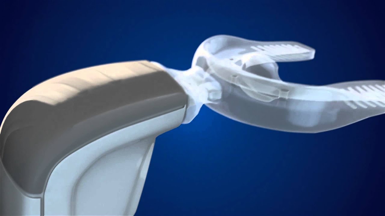 AcceleDent&reg; Aura - Leader in Accelerated Orthodontics&trade;- Product Testimonials