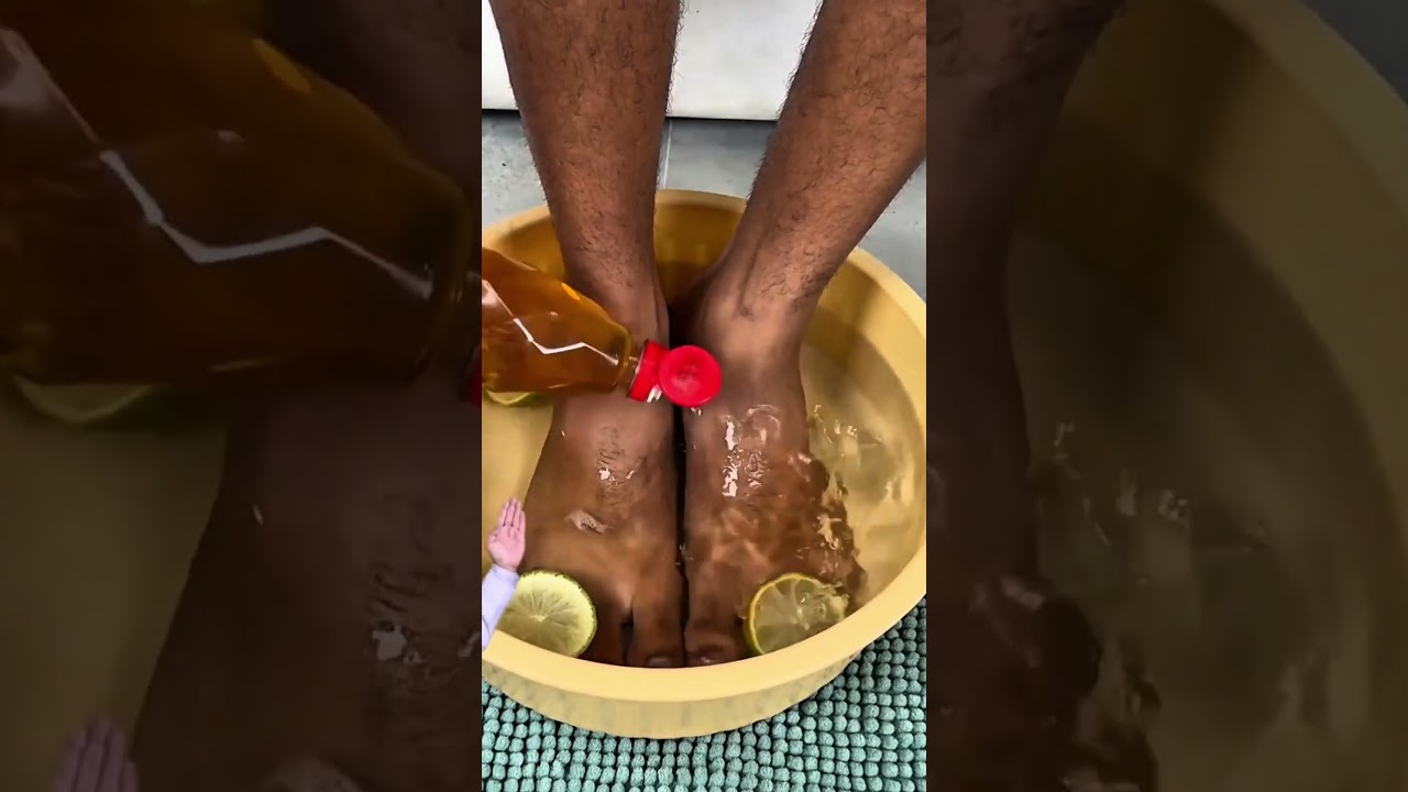 Simply add a few lemon slices to your feet #shorts #feet