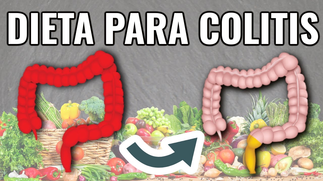 DIETA PARA COLITIS: síndrome de intestino irritable (dieta baja en fodmaps)