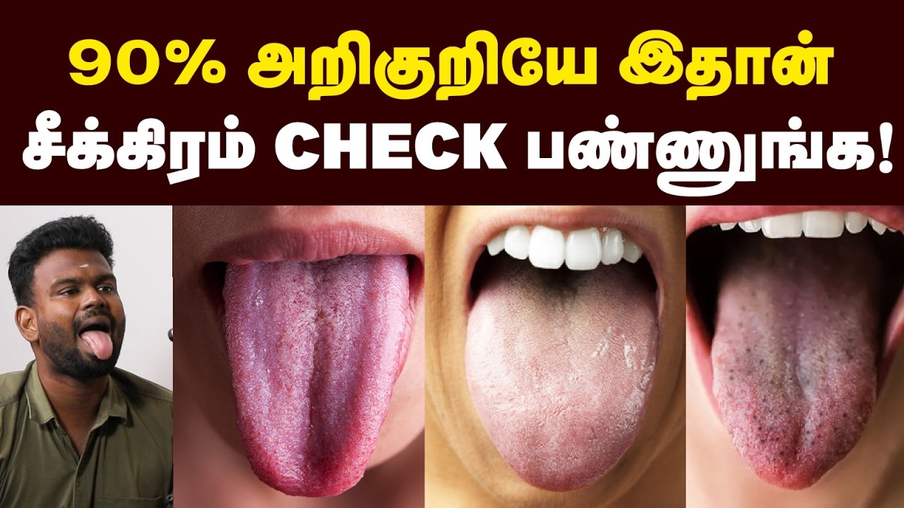 “நாக்கு தான் முதல் சிக்னல்!🥶| இந்த நிறம் இருந்தா உடம்புல பிரச்சனைதான்! 😕| Tongue color | Tongue tips