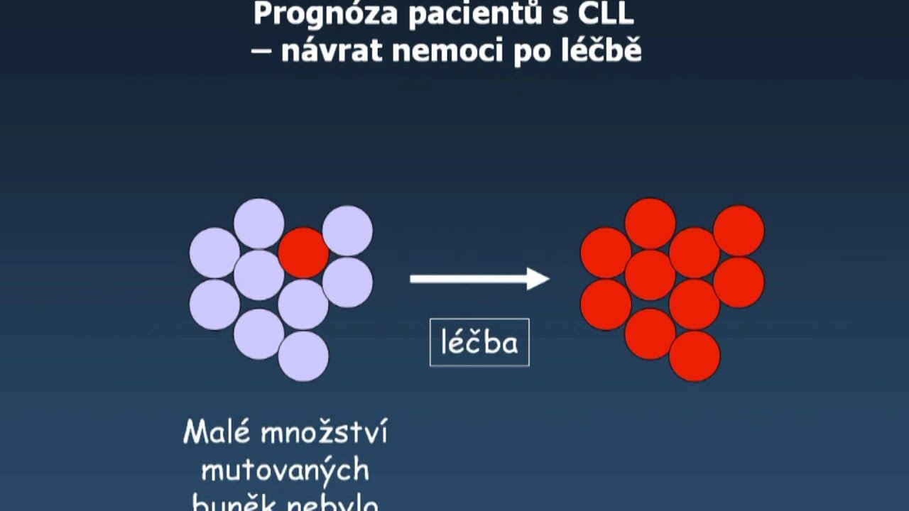 11 Prognóza CLL