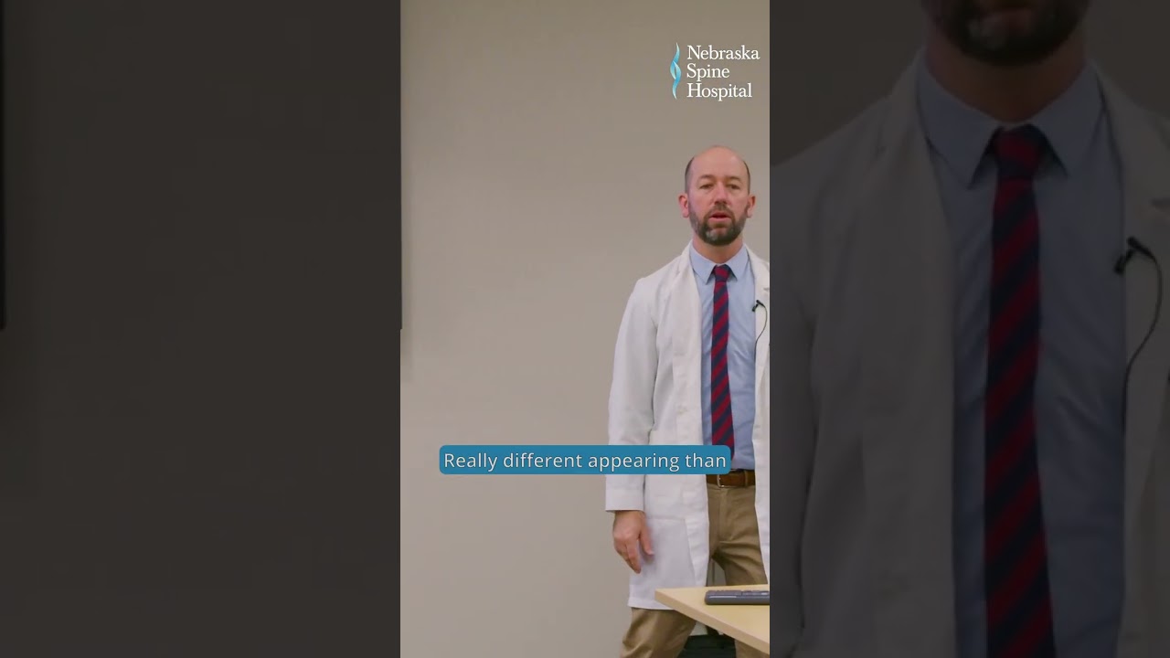 Neuromuscular Scoliosis