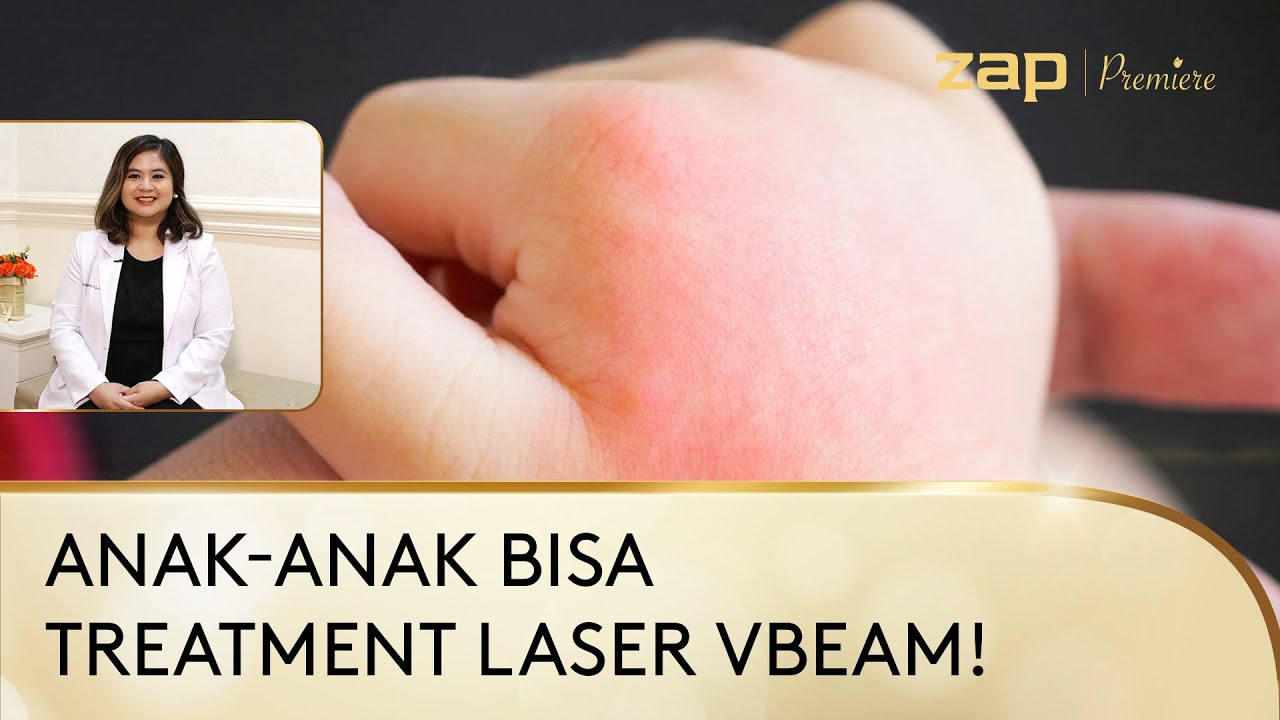 Mengatasi Hemangioma Pada Anak Dengan Treatment Laser!