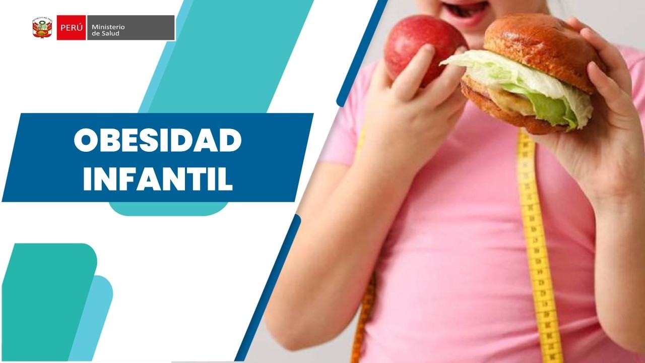 OBESIDAD INFANTIL