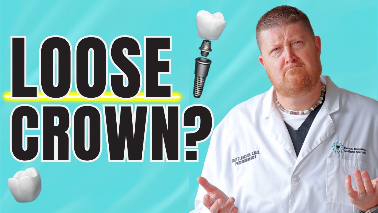 Loose Dental Crown or Implant: When It’s Safe to Wait (and When It’s Not)