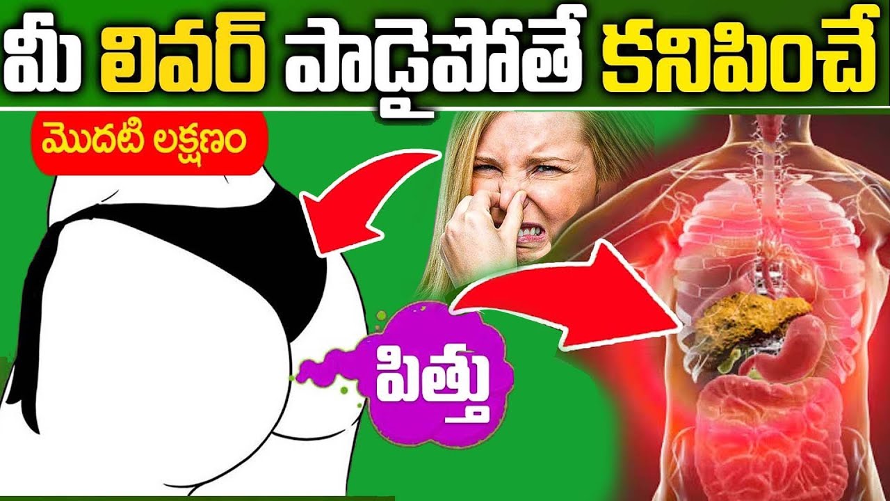 Kidney Disease Symptoms In Telugu || Veeramachaneni ramakrishna || iD Health 360