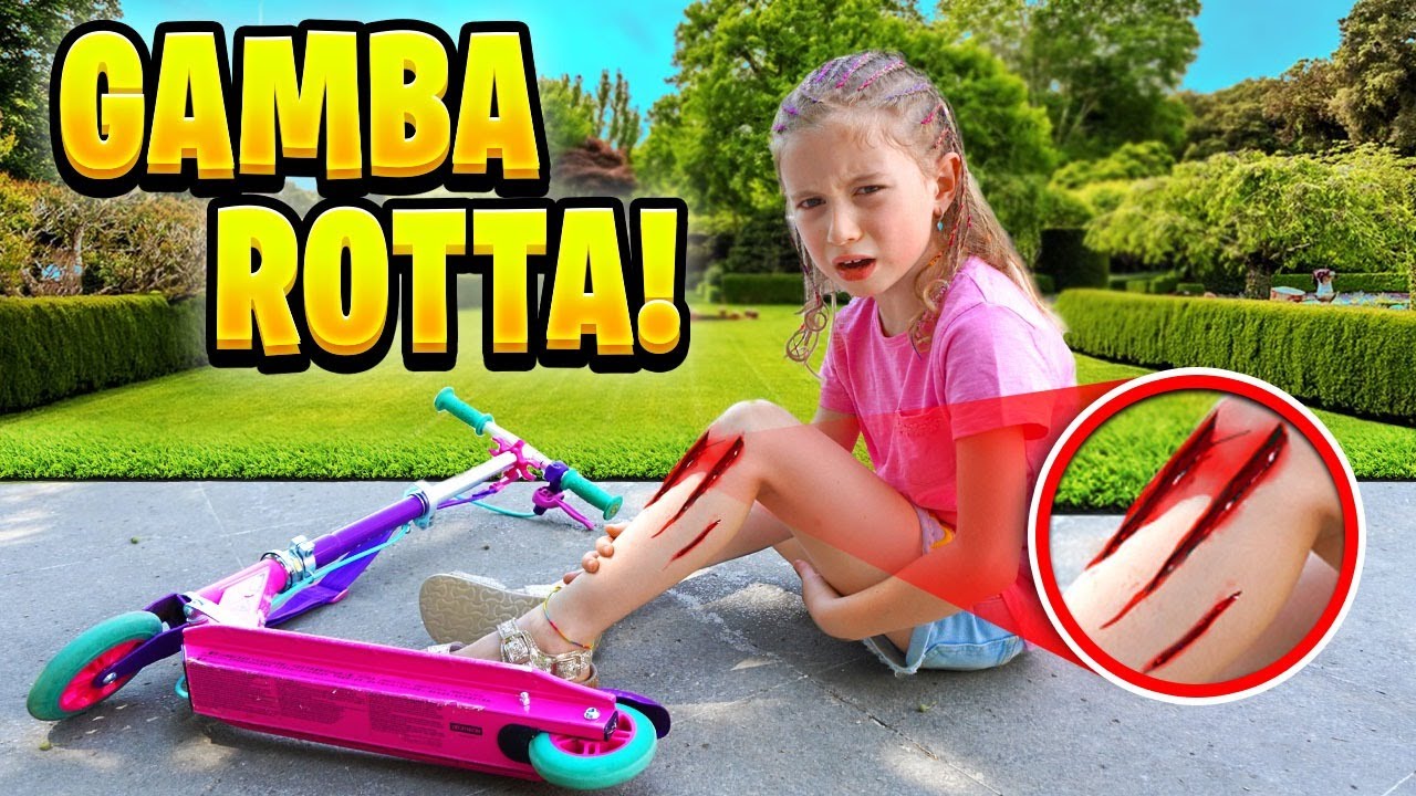 GIORGIA CADE SI FA MALE E SI ROMPE LA GAMBA MENTRE VA IN MONOPATTINO PER LA PRIMA VOLTA! *Piange*