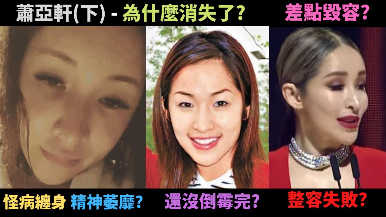 為什麼蕭亞軒消失了,六年沒發片?認真分析真的有整容嗎,差點毀容了?商演喊場天后?還在倒霉?