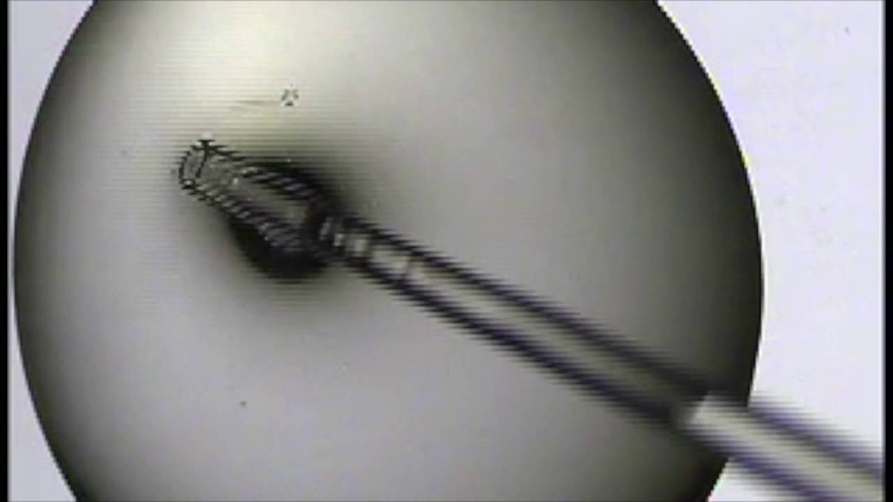 Blastocyst Vitrification in Real Time- Dr Jay Mehta