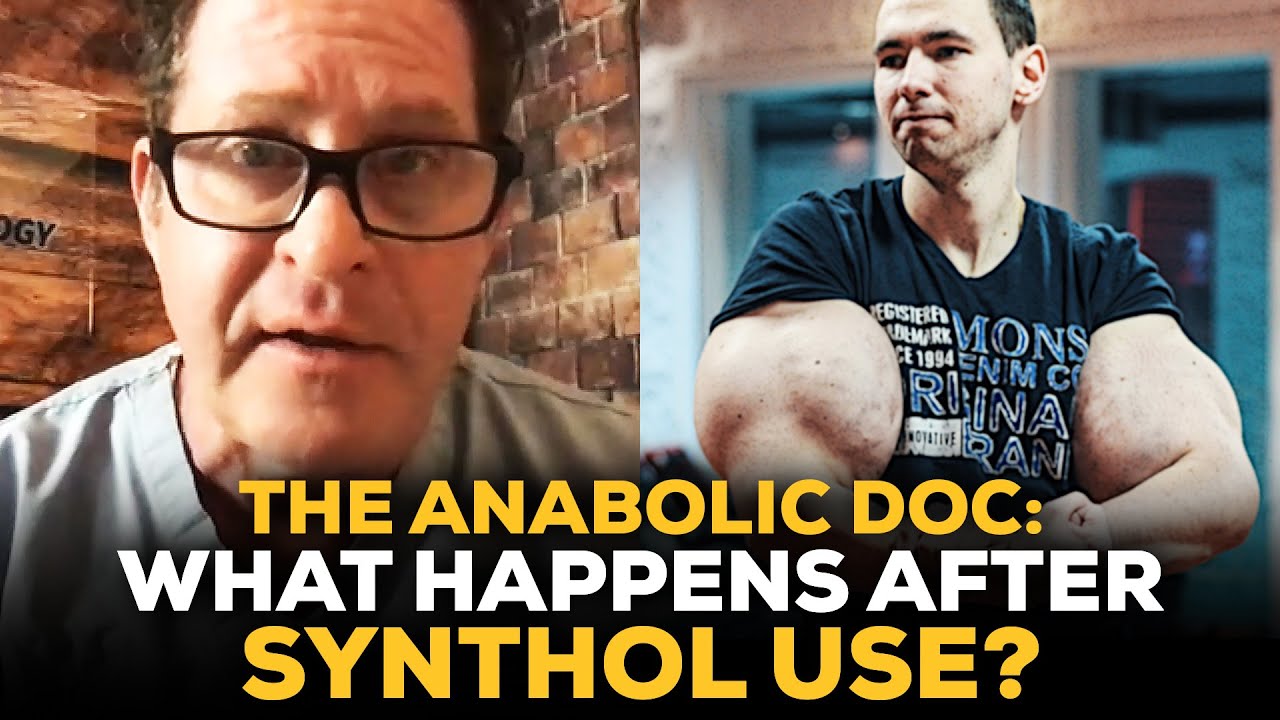 The Anabolic Doc: The Realities Of What Happens After Synthol Use