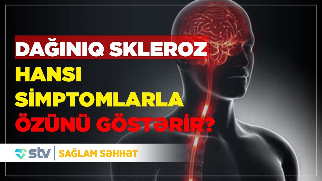 DAĞINIQ SKLEROZ HANSI SİMPTOMLARLA ÖZÜNÜ GÖSTƏRİR?