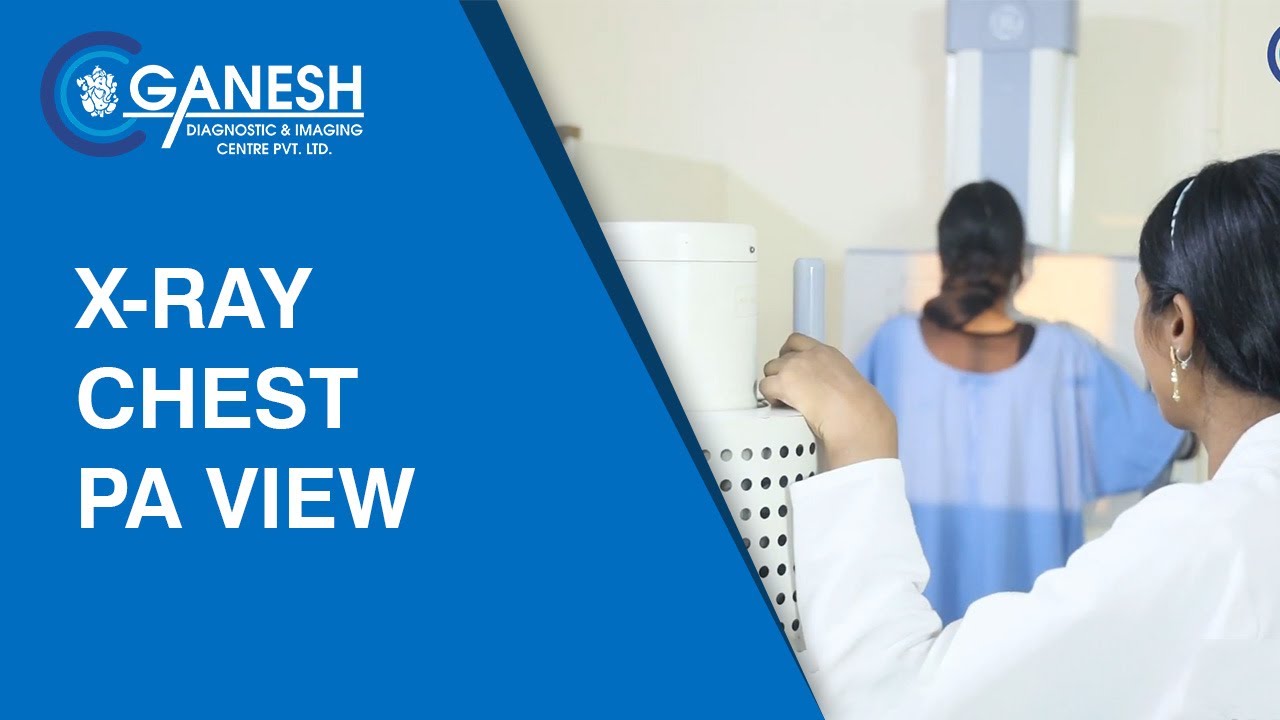 X-Ray Chest PA View - Test Purpose & Complete Procedure | Ganesh Diagnostic