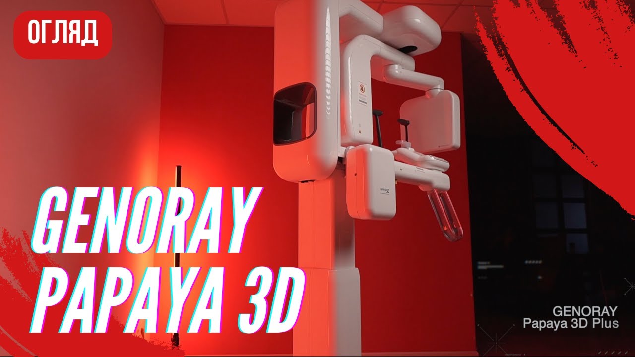 Огляд комп'ютерного томографа Genoray Papaya 3D