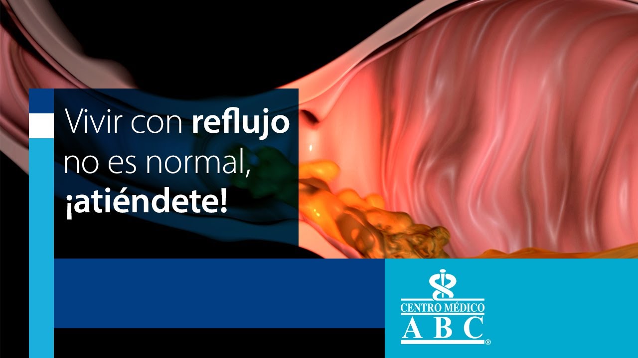 S&iacute;ntomas del reflujo gastroesof&aacute;gico
