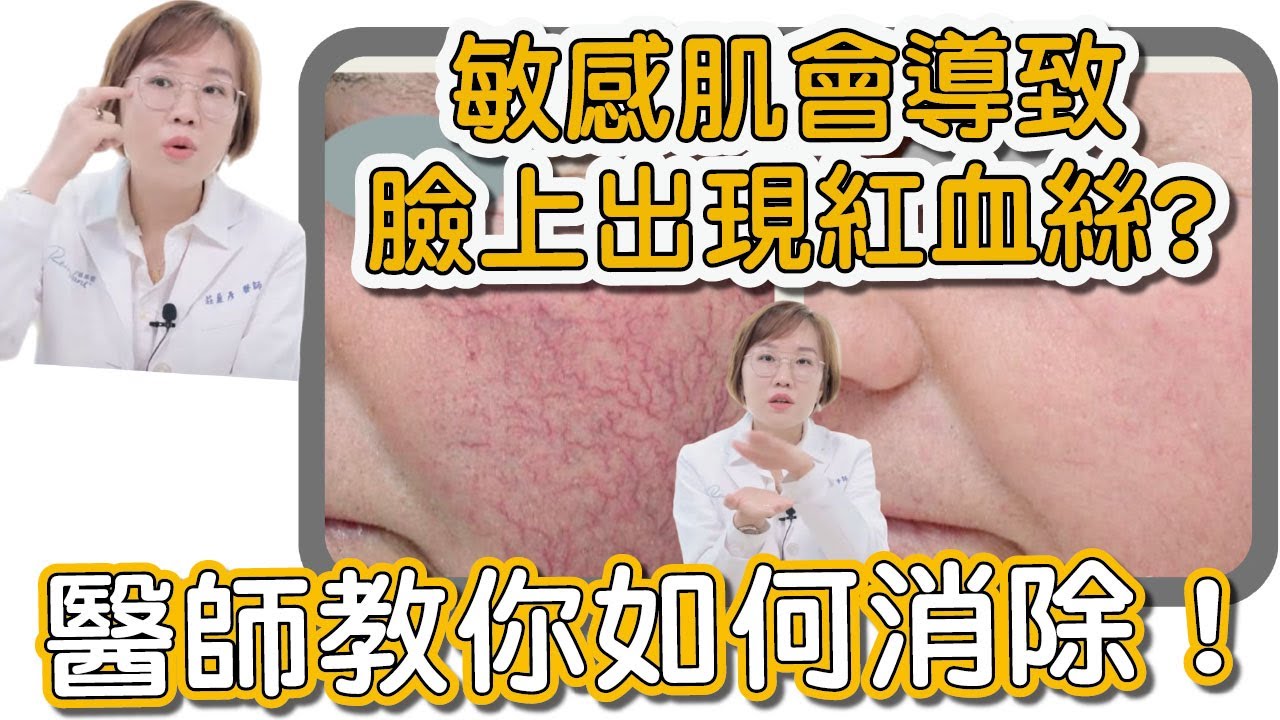 臉上出現紅血絲就代表皮膚薄、敏感？讓你臉上紅血管明顯的原因是這些！