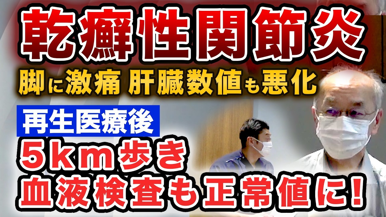 【乾癬性関節炎（慢性疼痛）再生医療】幹細胞治療により肝臓の数値も改善！！２億個投与の威力で主訴以外でも効果が出ました。