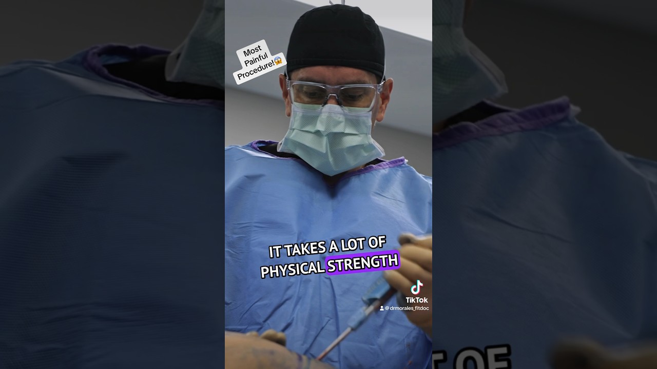 This procedure hurts the most!!! #pain #painful #ithurts