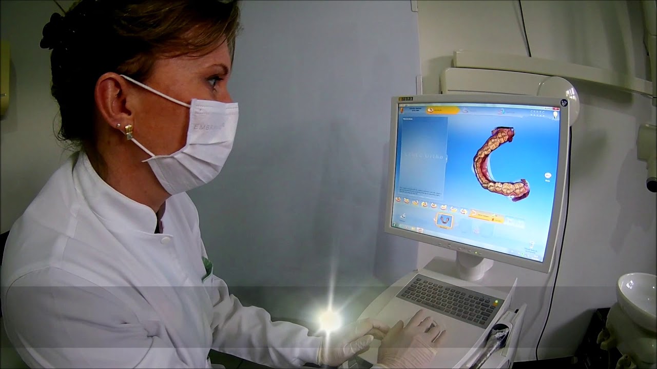 Scanner Intraoral - Digital Face Radiologia