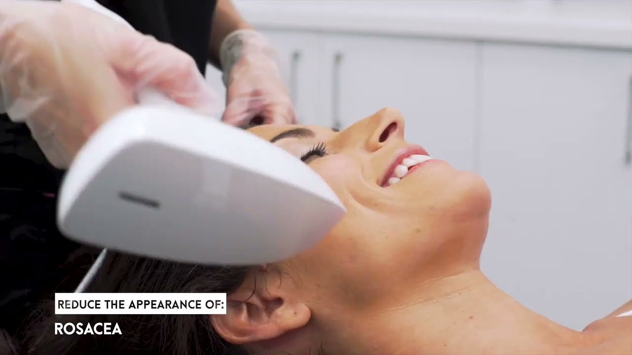 TriBella™ Photofacial, Anti-aging and Skin Resurfacing