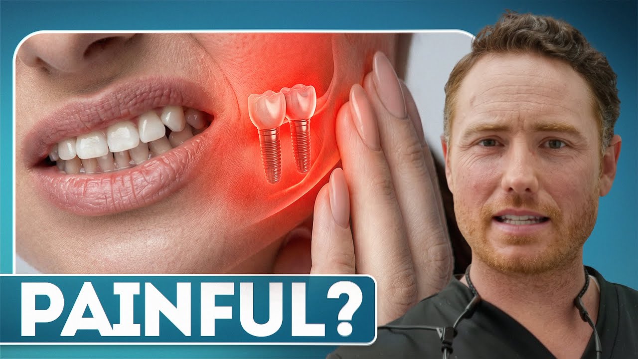 How Bad Do Dental Implants REALLY Hurt?