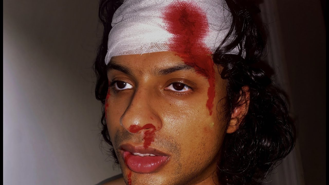 I WAS GOING TO DIE IN DELHI (HEAD INJURY)