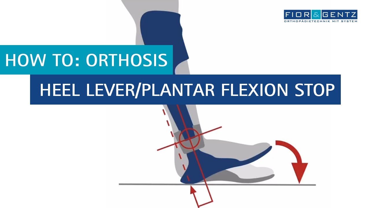 EN: How to: orthosis – Heel Lever/Plantar Flexion Stop
