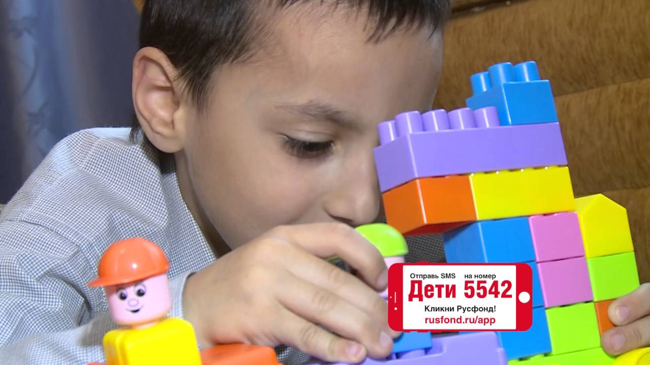Тигран Иванян, 5 лет, синдром Пьера Робена (недоразвитие нижней челюсти)