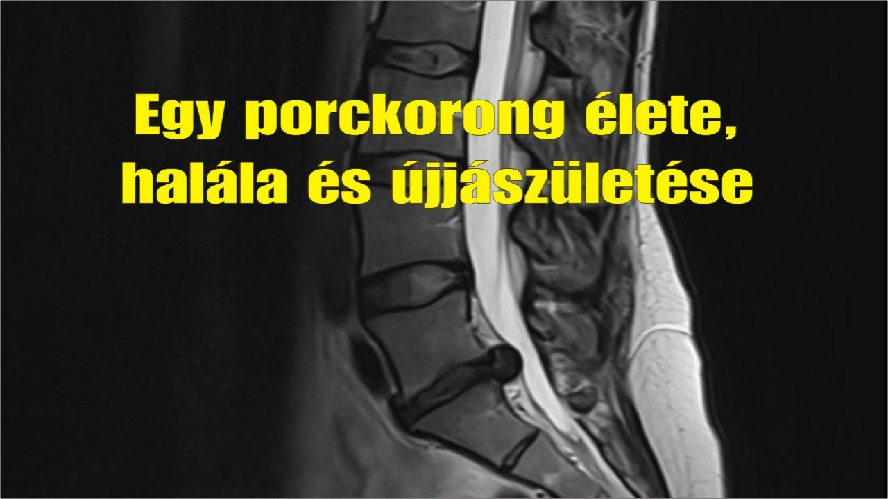Egy porckorong élete, halála és újjászületése a Spine Trainer System segítségével