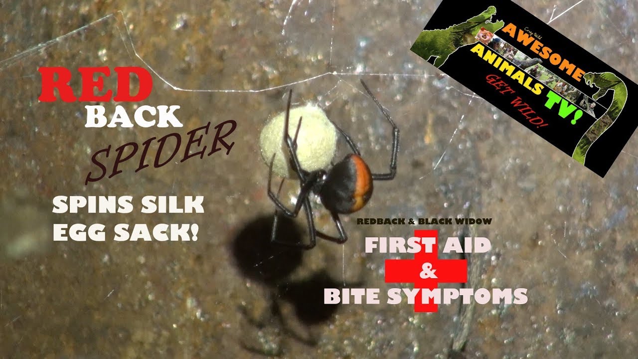 RED BACK & Black WIDOW  FIRST AID and Bite Symptoms!