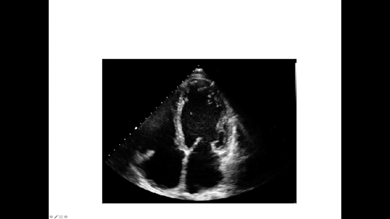 Cardiac anatomy for radiology - part 7 - other imaging modalities