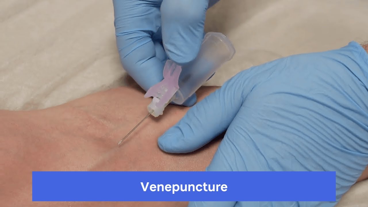 Venepuncture