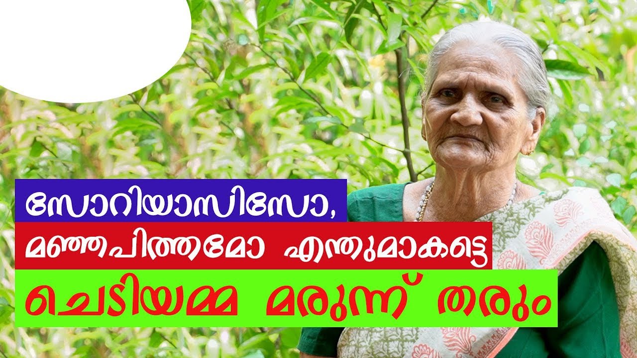 സോറിയാസിസോ മഞ്ഞപിത്തമോ എന്തുമാകട്ടെ ചെടിയമ്മ മരുന്ന് തരും/Herbal remedies for Psoriasis,jaundice...