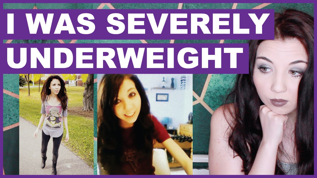 I Was Severely Underweight | Called Anorexic