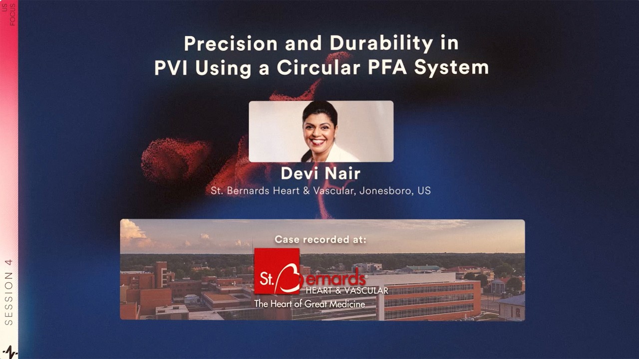 RIO 2026 | Case & Discussion: Precision and Durability in PVI using Circular PFA system