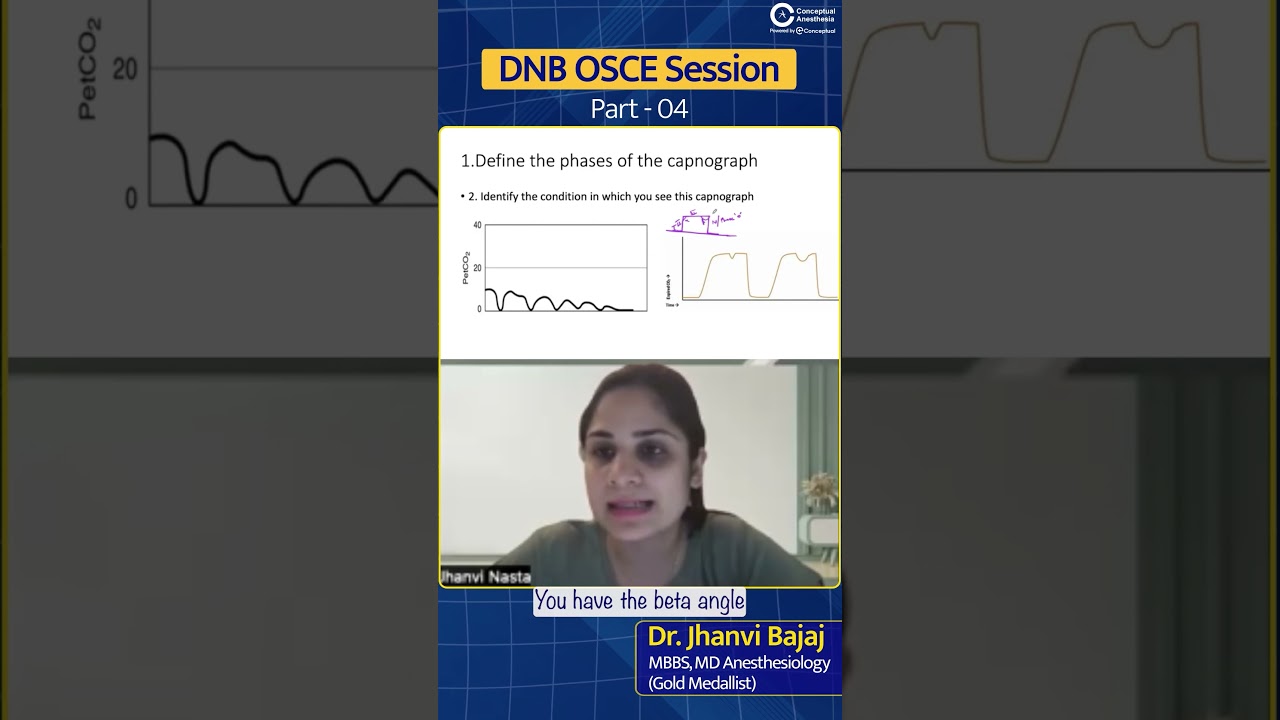 DNB OSCE Discussion by Dr. Jhanvi Bajaj | Part - 4 | Conceptual Anesthesia