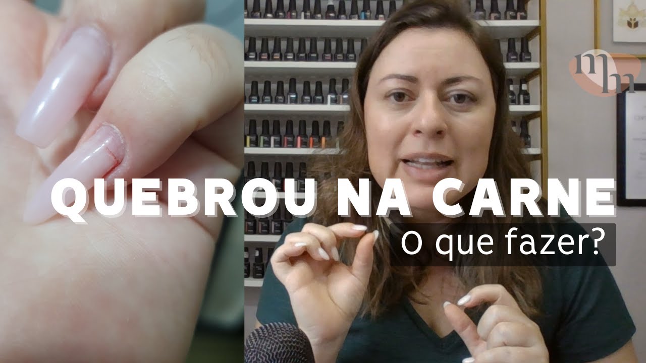 Minha unha quebrou na carne!! O que devo fazer?