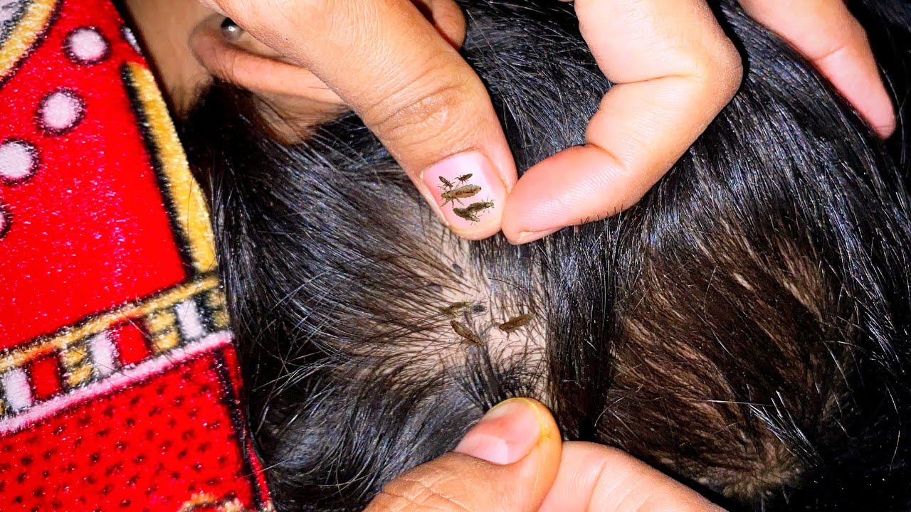 Lice Checking ASMR part1 #lice #piojos #kututv #letecia #haircare #asmr 