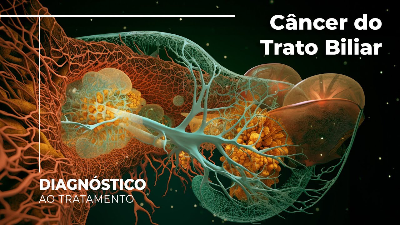 Desvendando os Mistérios do Câncer do Trato Biliar: Um Mergulho Profundo no Colangiocarcinoma