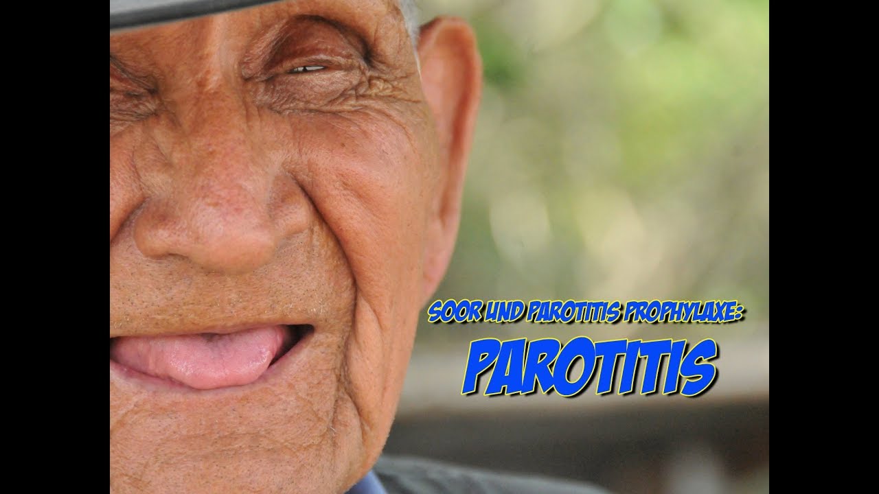 Soor und Parotitis Prophylaxe - Parotitis