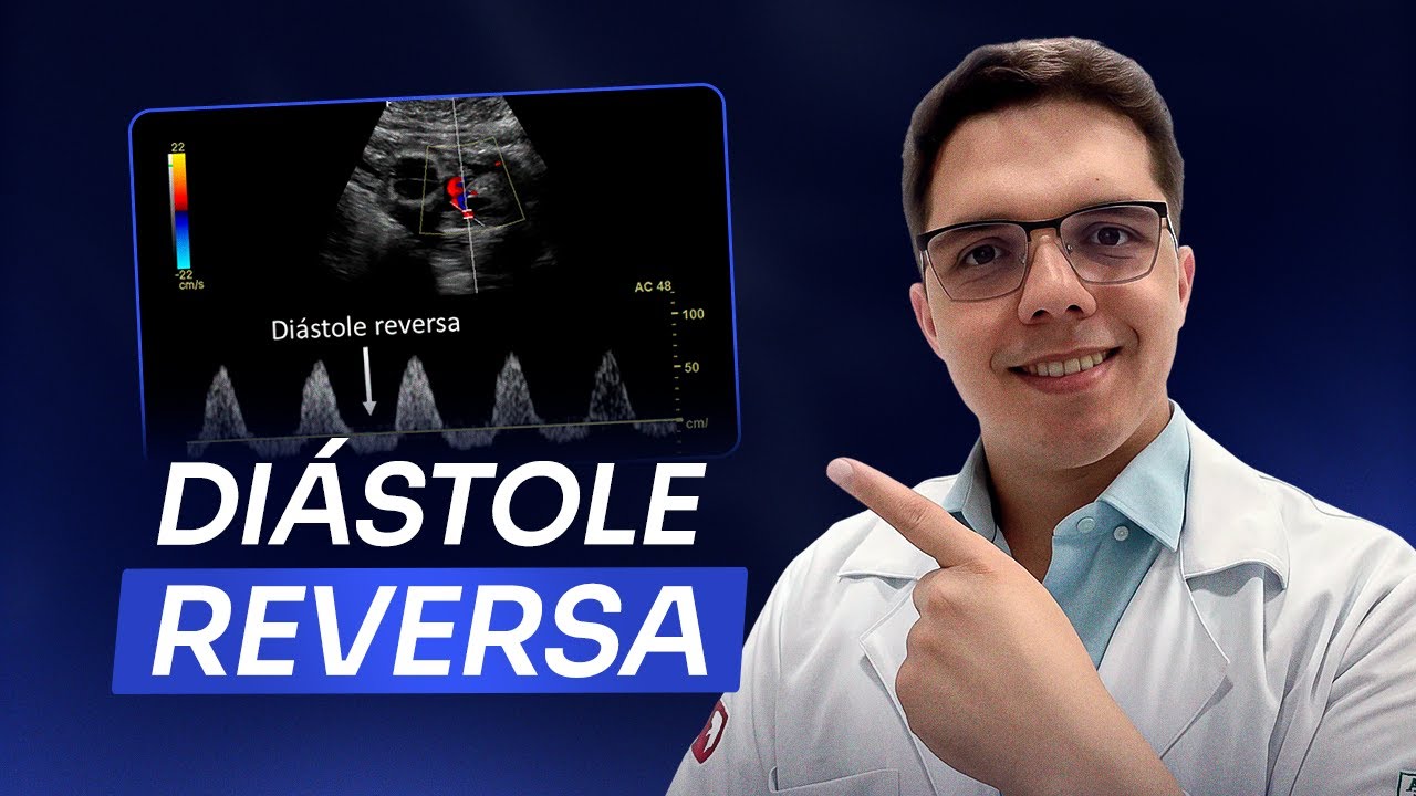 Como realizar Doppler da Artéria Umbilical | Ultrassom obstétrico