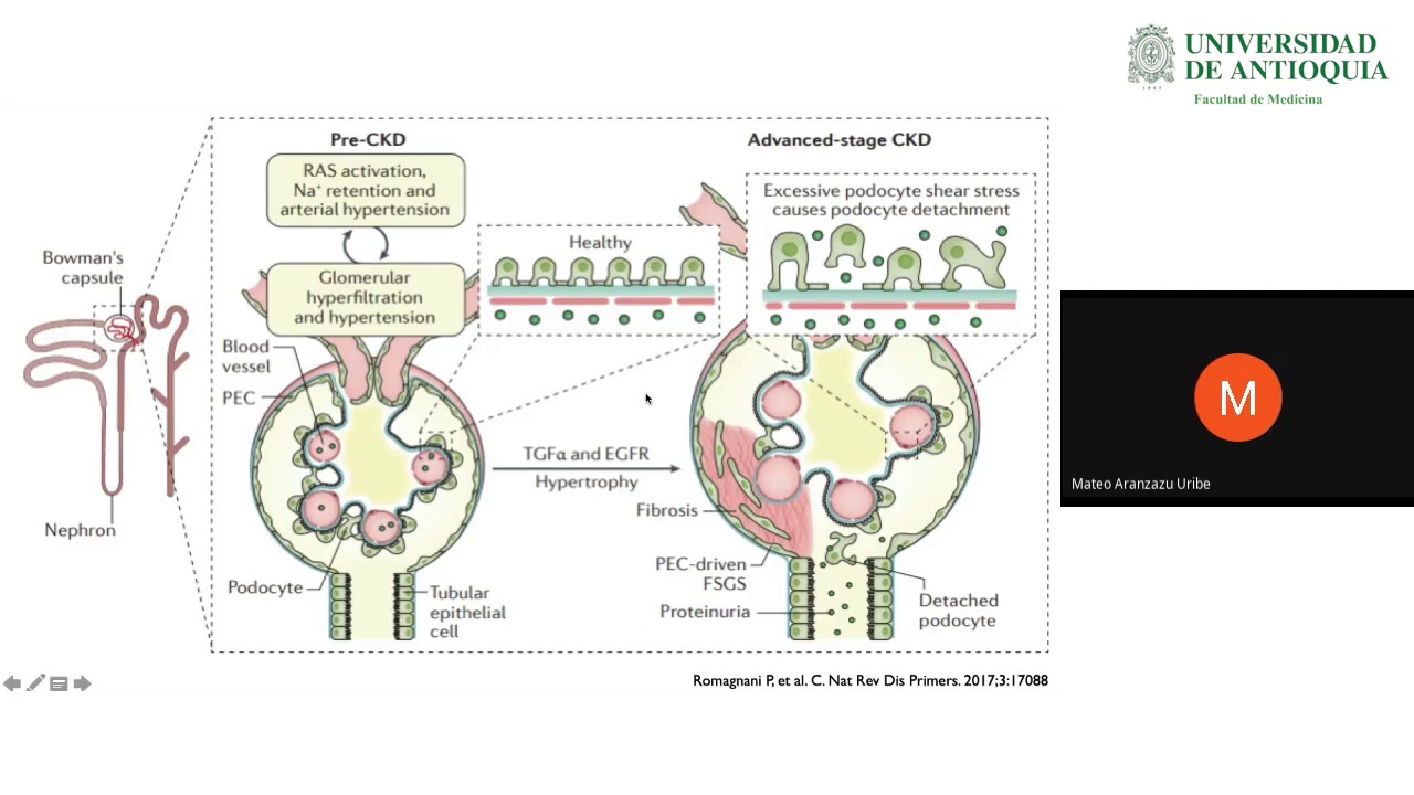 Generalidades Enfermedad Renal Crónica - Dr. Mateo Aranzazu
