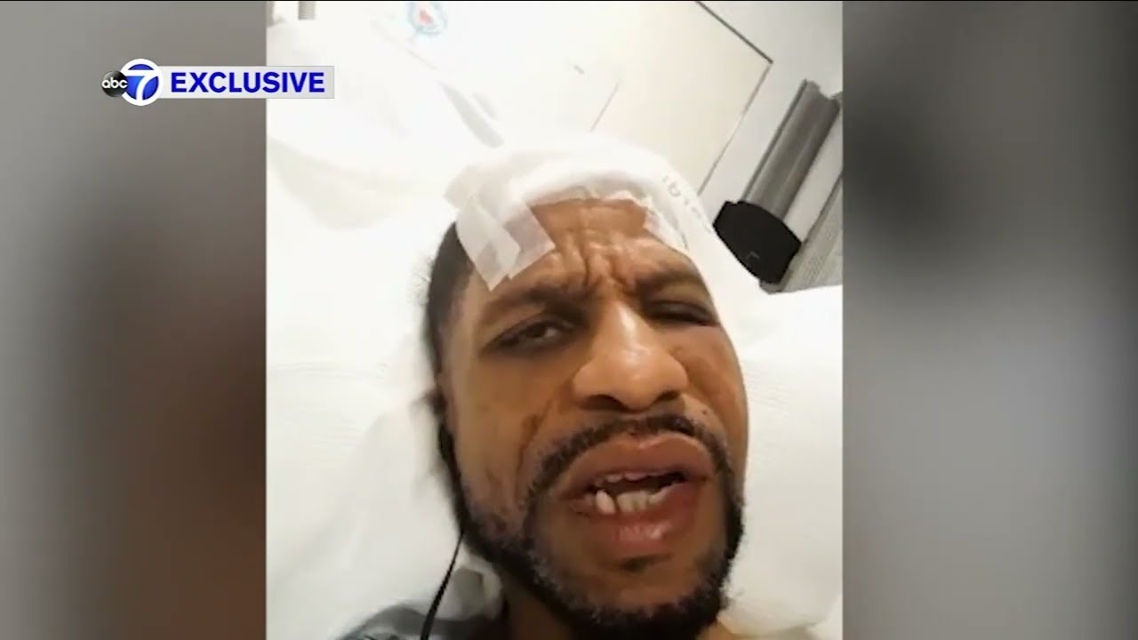 Man says he was assaulted trying to help woman being attacked