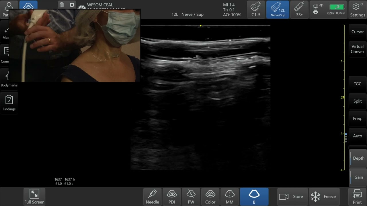 ICCNMI2021 - Anatomy and scan demo of the small nerves in the neck