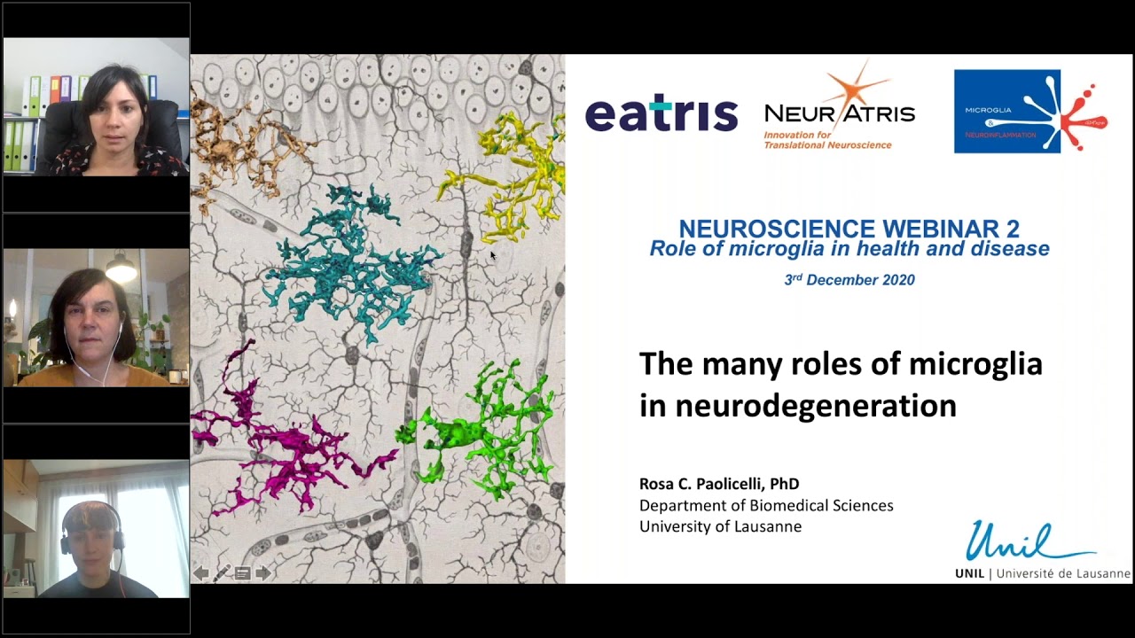 Role of microglia in health and disease