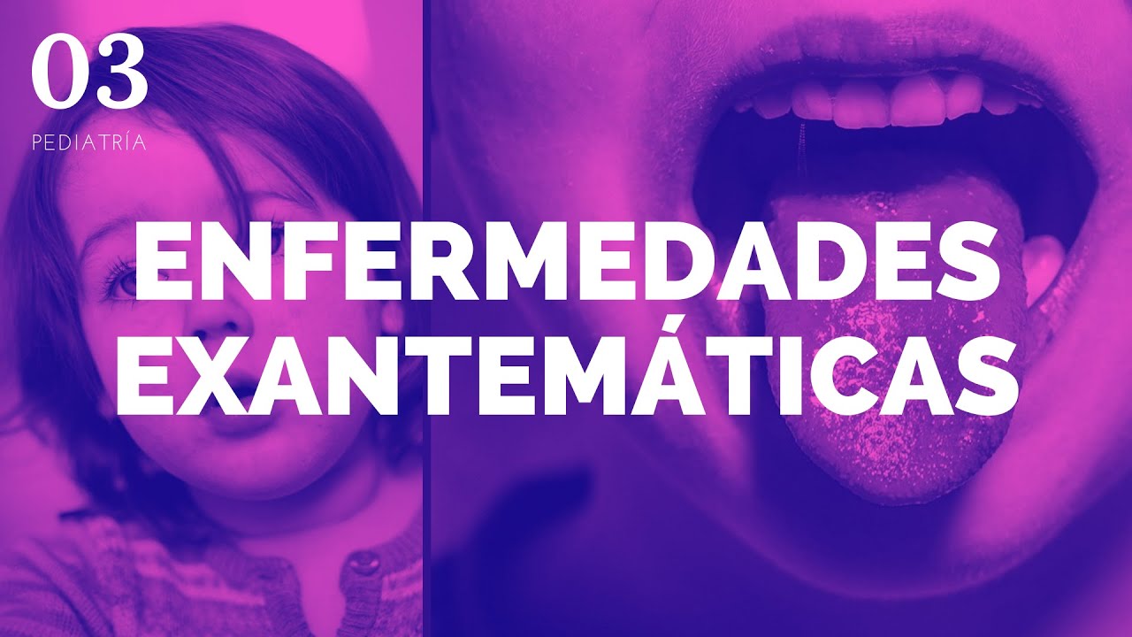 Exantemáticas - ENARM