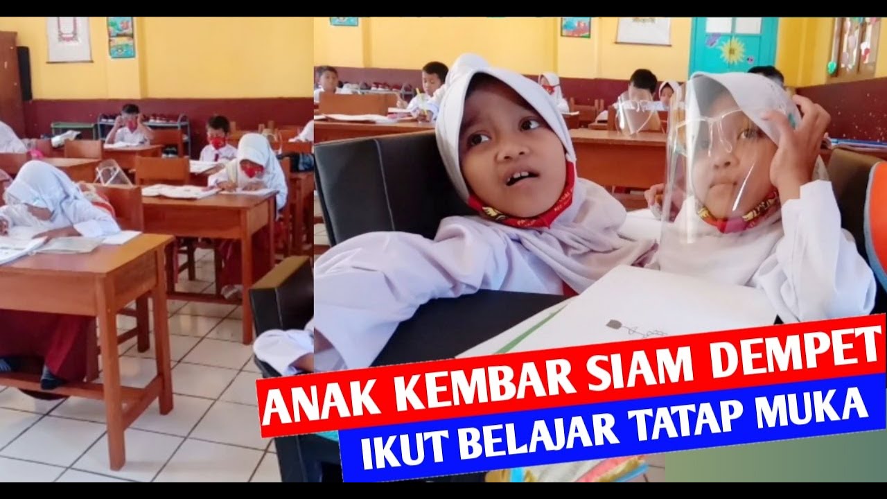 Anak Kembar Siam Dempet di Garut Ikut Belajar Tatap Muka di Sekolah